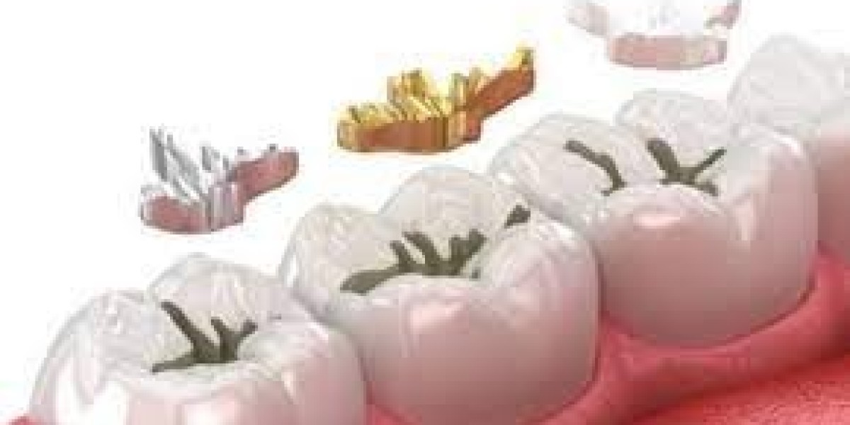 Tooth Filling Materials Market Barriers and Opportunities: Strategic Forecast, Key Insights, Innovations, and Competitiv