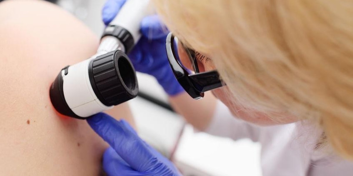How Much Does Skin Tag Removal Cost in Dubai? A Detailed Breakdown