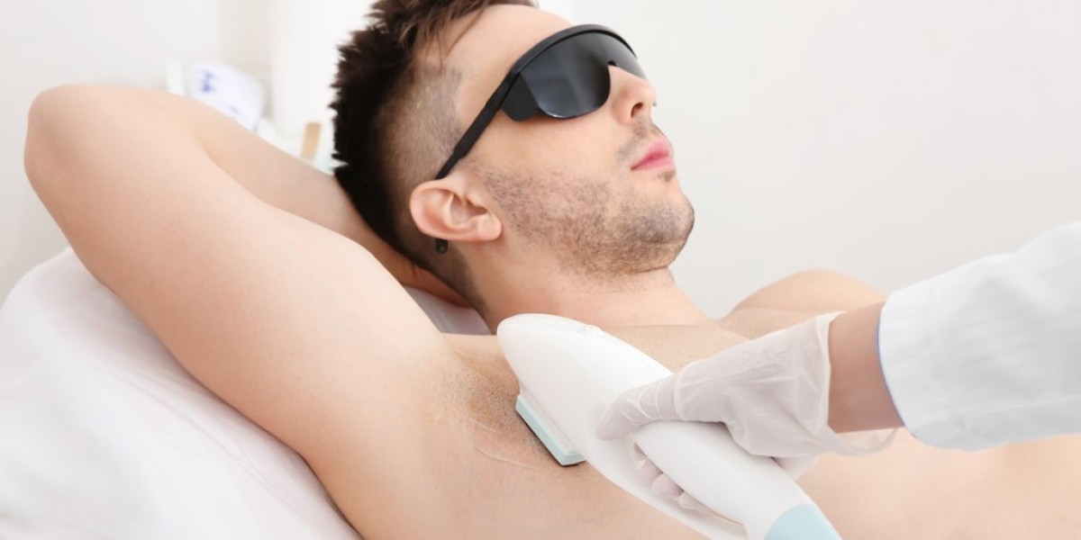 Laser Hair Removal: What to Expect and How It Works