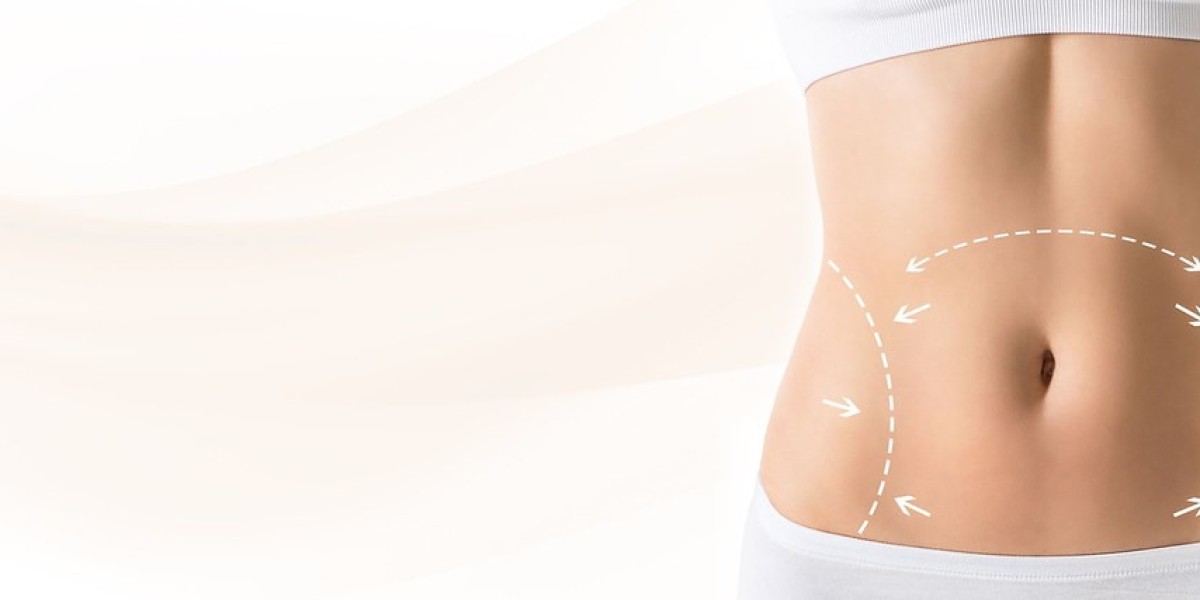 How to Find Board-Certified Tummy Tuck Surgeons in Riyadh