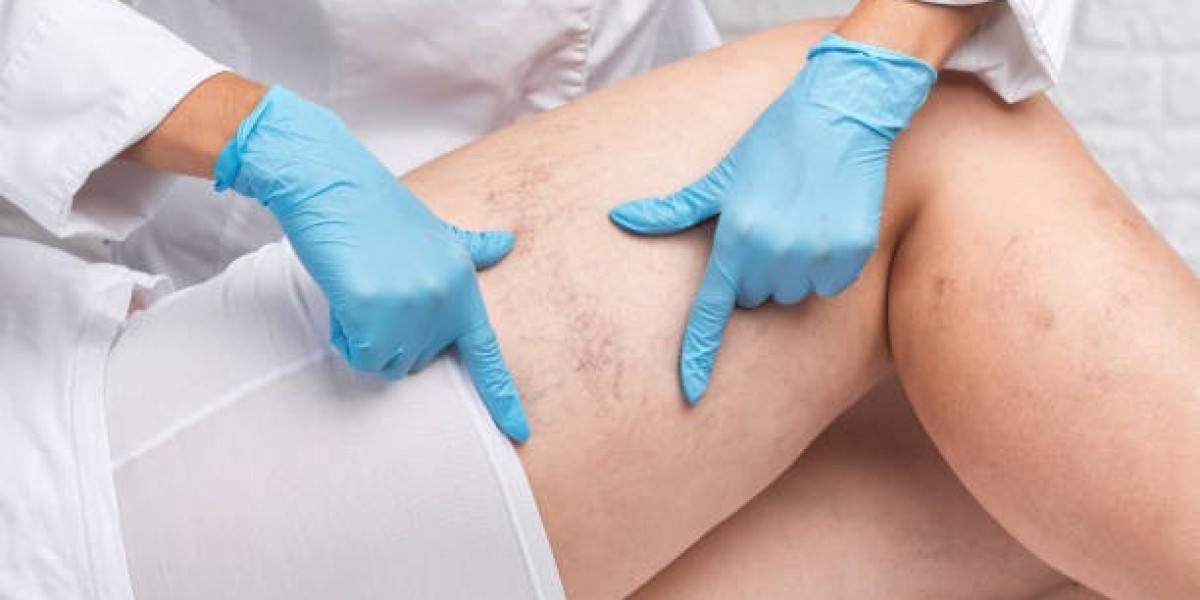 Vascular Surgery in Riyadh: From Diagnosis to Recovery