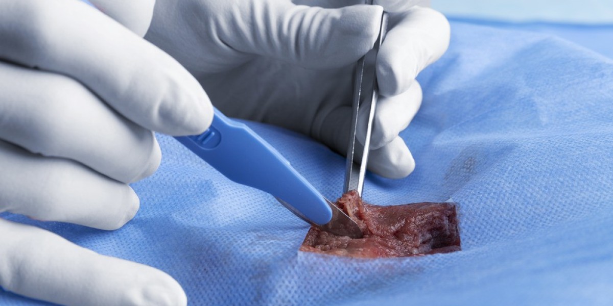 Understanding the Role of Amniotic Membrane Products in Pain Management