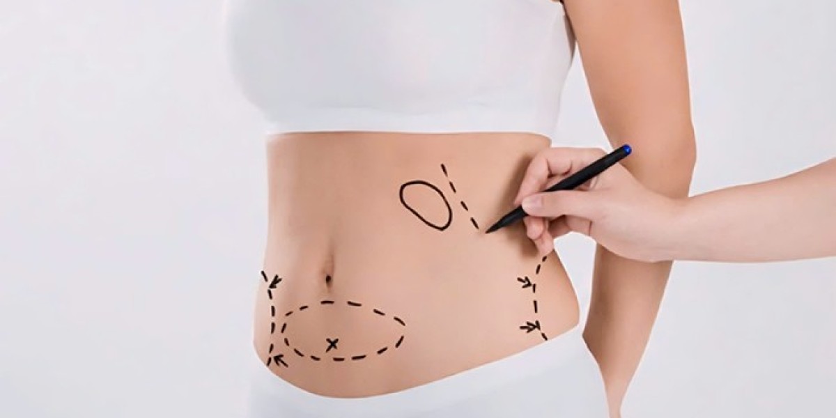 How Body Fillers Can Help with Cellulite Reduction in Dubai