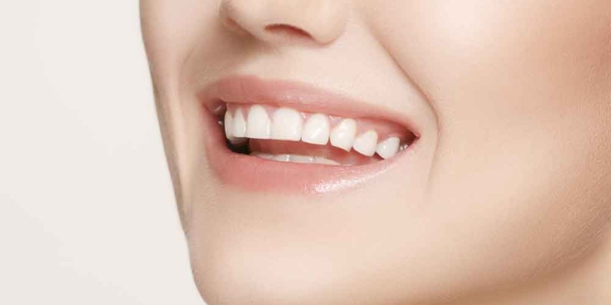 A Comprehensive Guide to Teeth Whitening Services in Duba