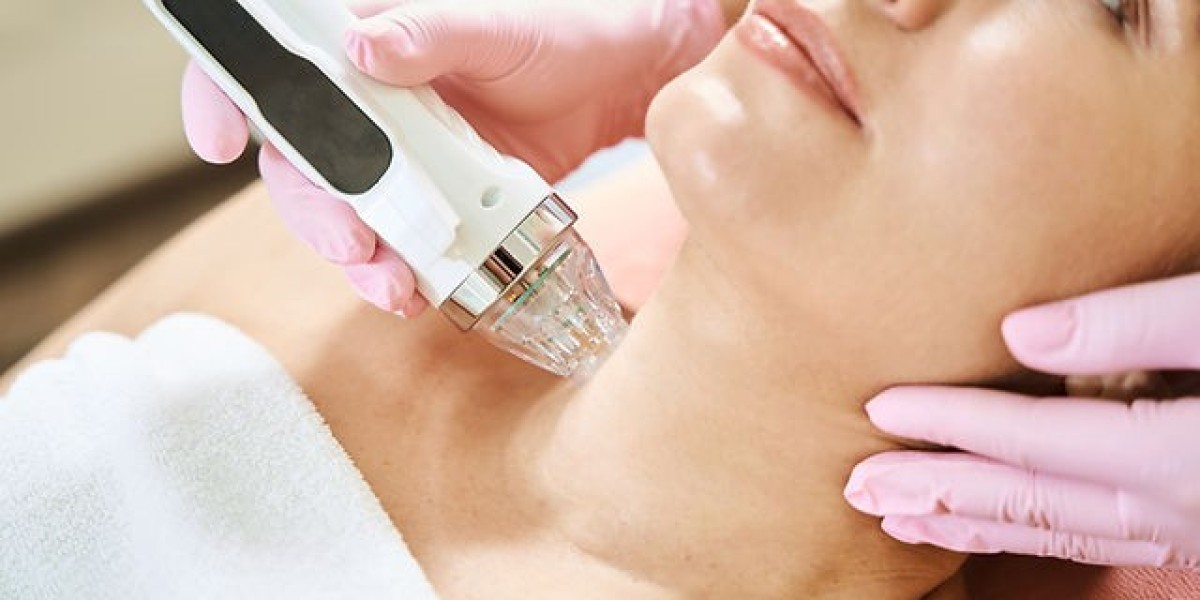 Fractional RF Microneedling: A Quick and Effective Solution for Skin Imperfections in Dubai