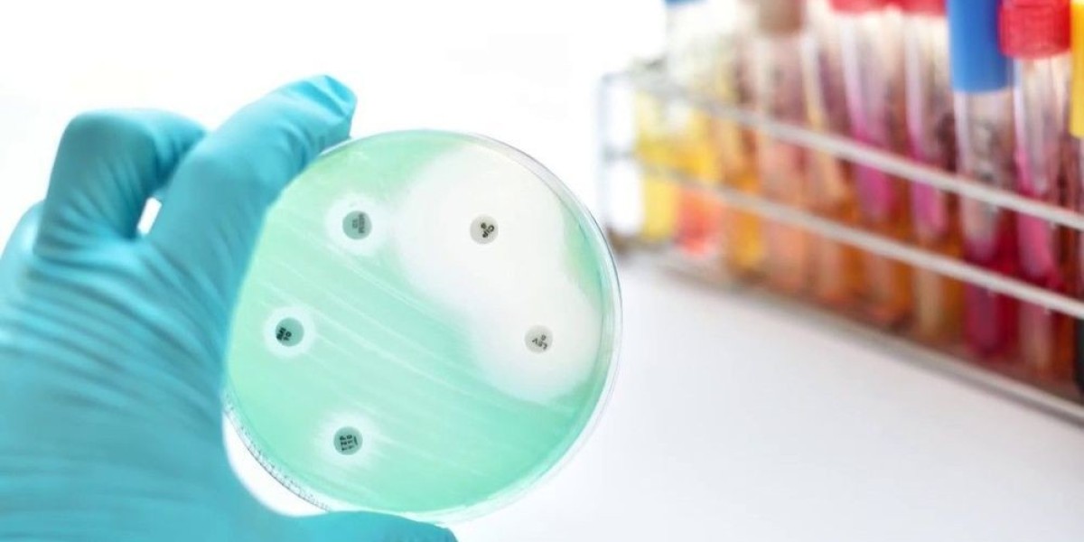 Antimicrobial Susceptibility Test Market: Advancements in Microbial Resistance Testing Platforms