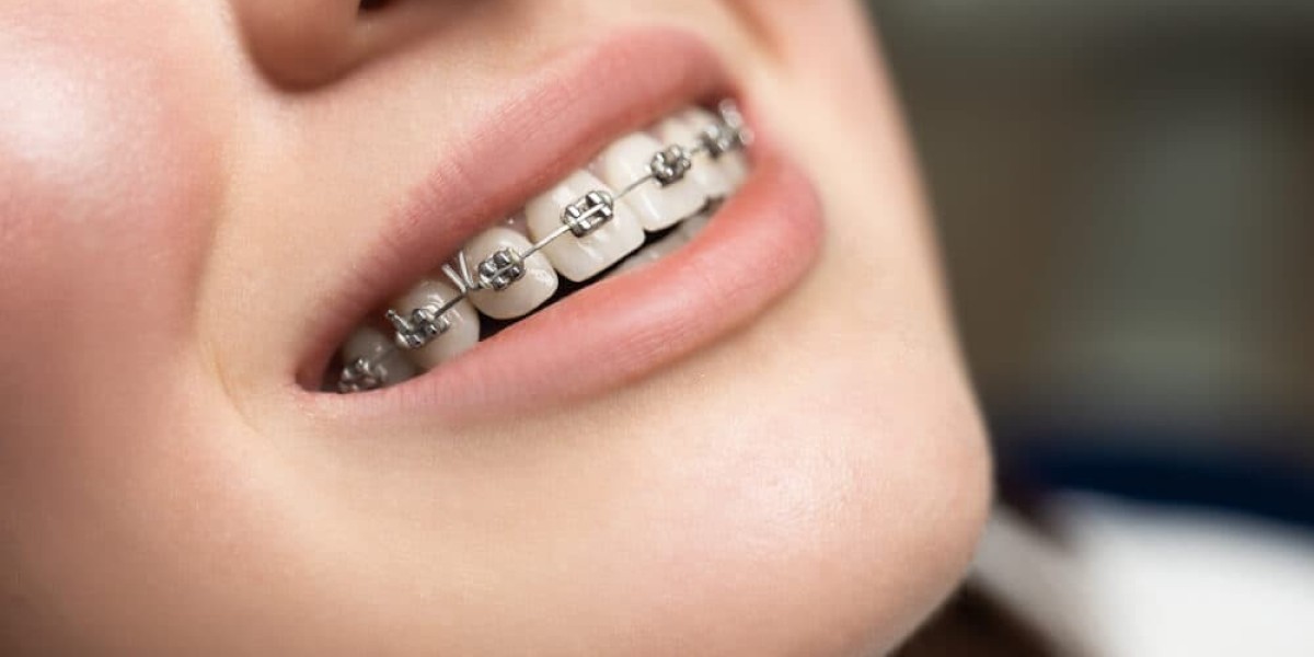 How much does orthodontic treatment cost for seniors needing braces in Dubai?