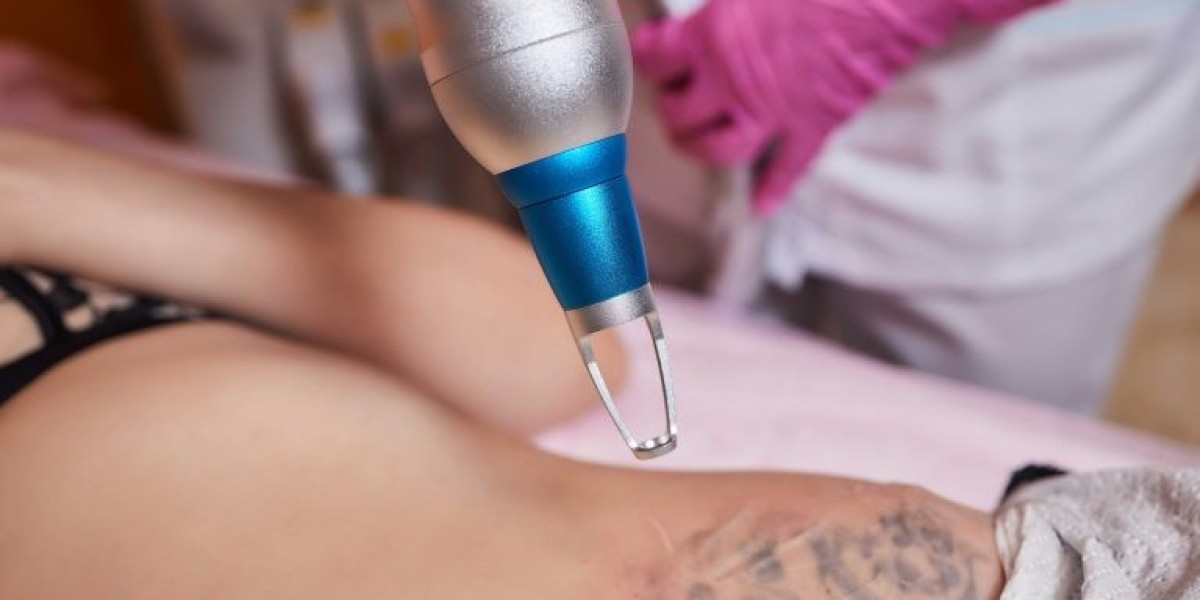 Picosure Tattoo Removal for Removing Old Tattoos in Dubai