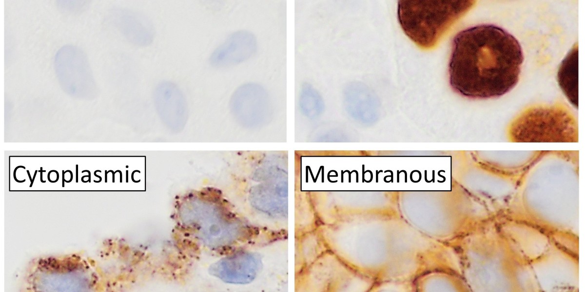 IHC Market Valued at $3.68 Billion in 2024: Trends and Insights