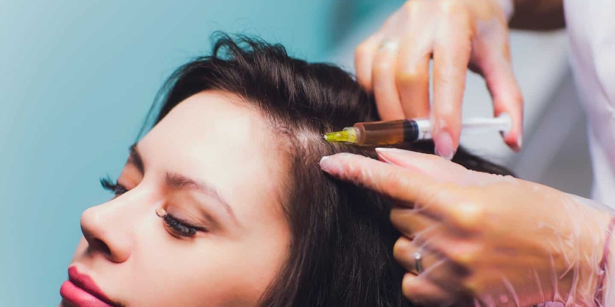 A Closer Look at PRP Hair Growth Treatment in Riyadh