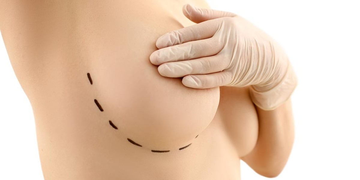 Breast Augmentation vs. Breast Lift: Which Procedure is Right for You?