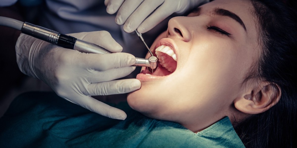 Root Canal Myths Debunked: Facts Every Dubai Resident Should Know