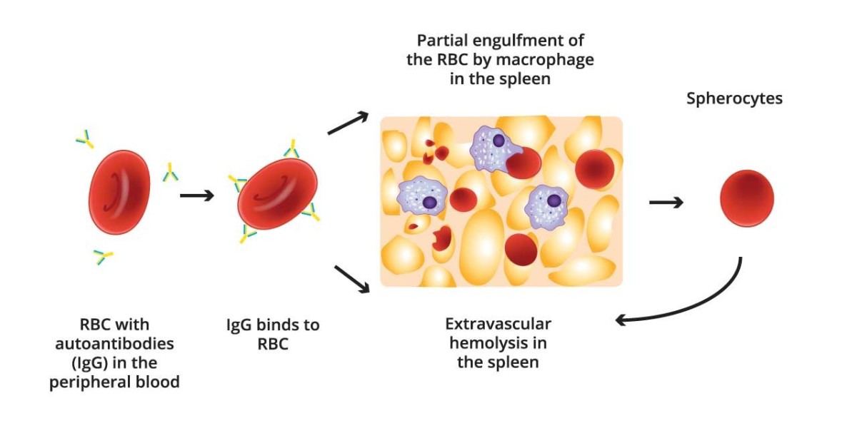 Warm Autoimmune Hemolytic Anemia Drug Pipeline Analysis Report 2024