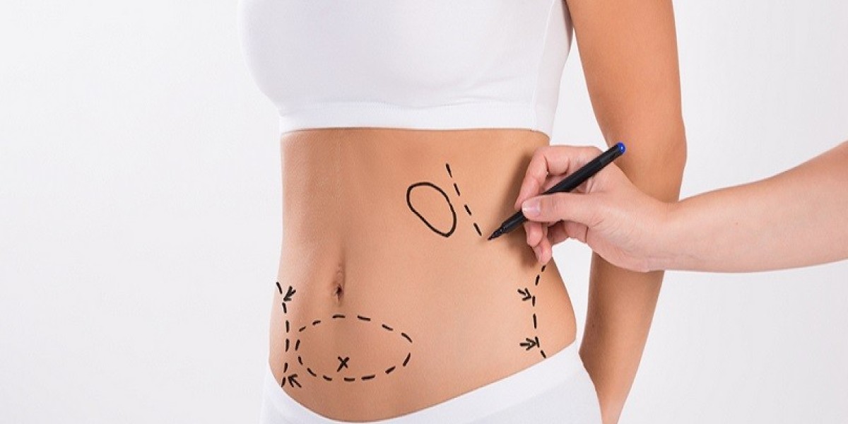 Mounjaro Injection in Dubai: Tips for a Successful Experience