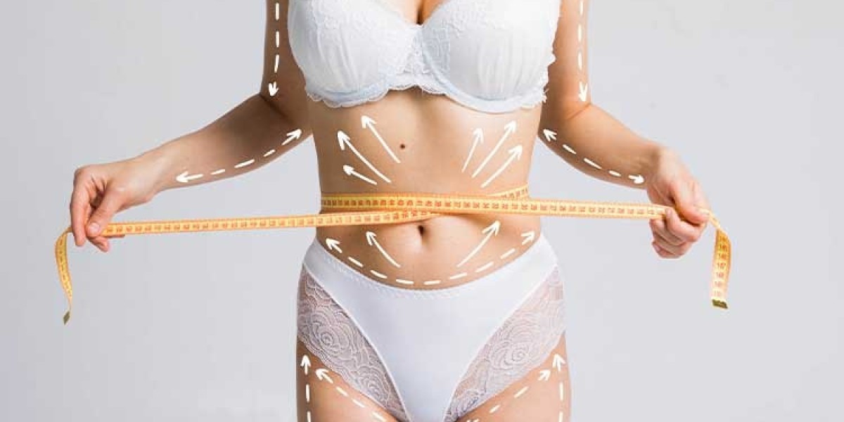 Best Clinics for Liposuction and Non-Surgical Fat Removal in Dubai