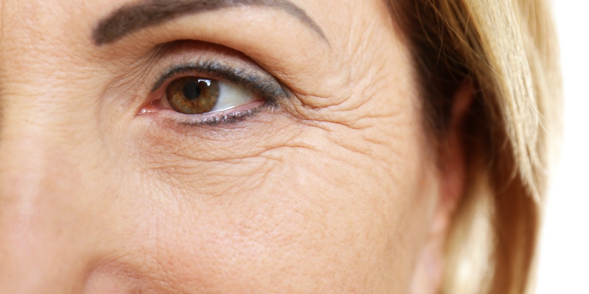 Finding the Right Anti-Aging Specialist in Riyadh for Fine Lines