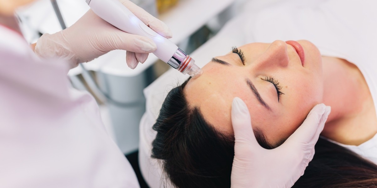HydraFacial for Acne-Prone Skin in Riyadh