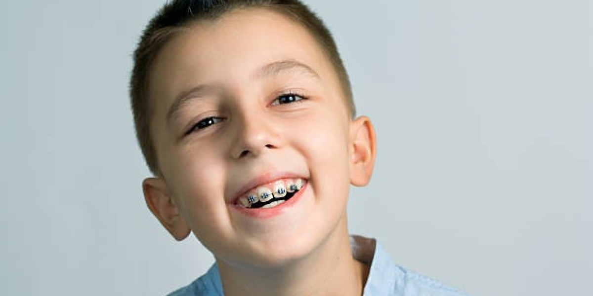 Perfect Your Smile with Braces in Riyadh
