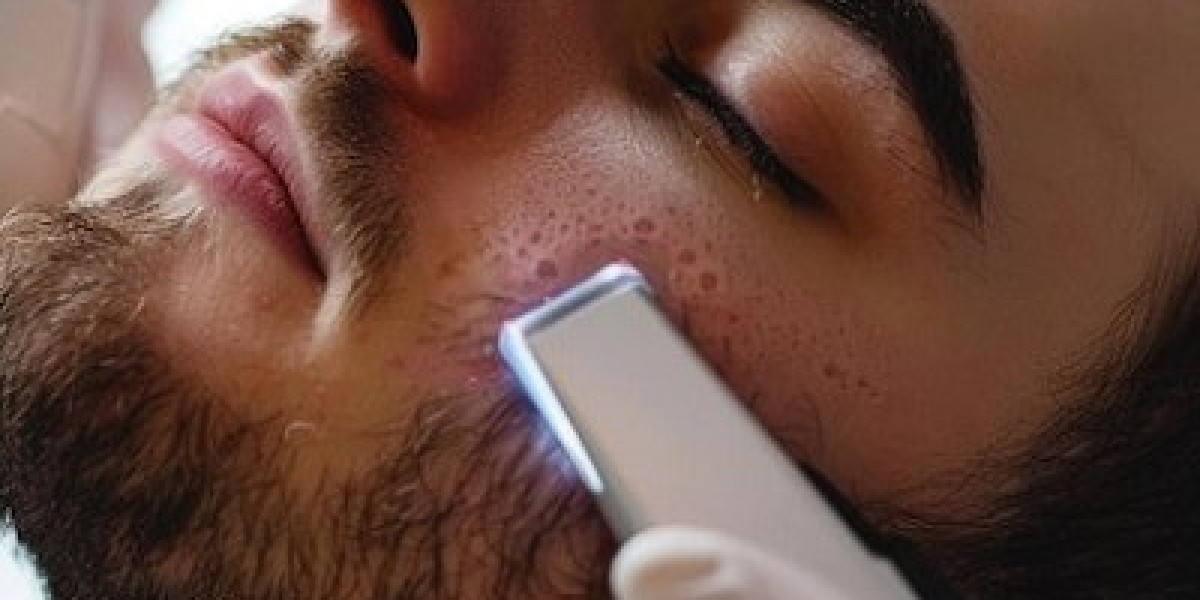 Why Choose Dubai for Beard Laser Hair Removal Treatments?