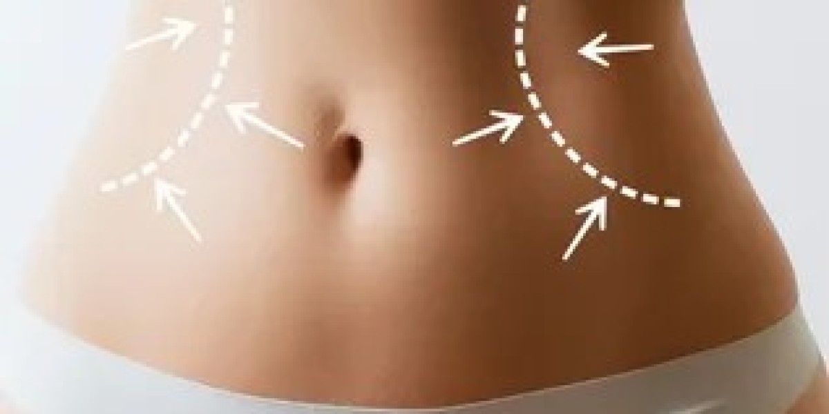 Say Goodbye to Stubborn Fat: Exploring Liposuction in Islamabad