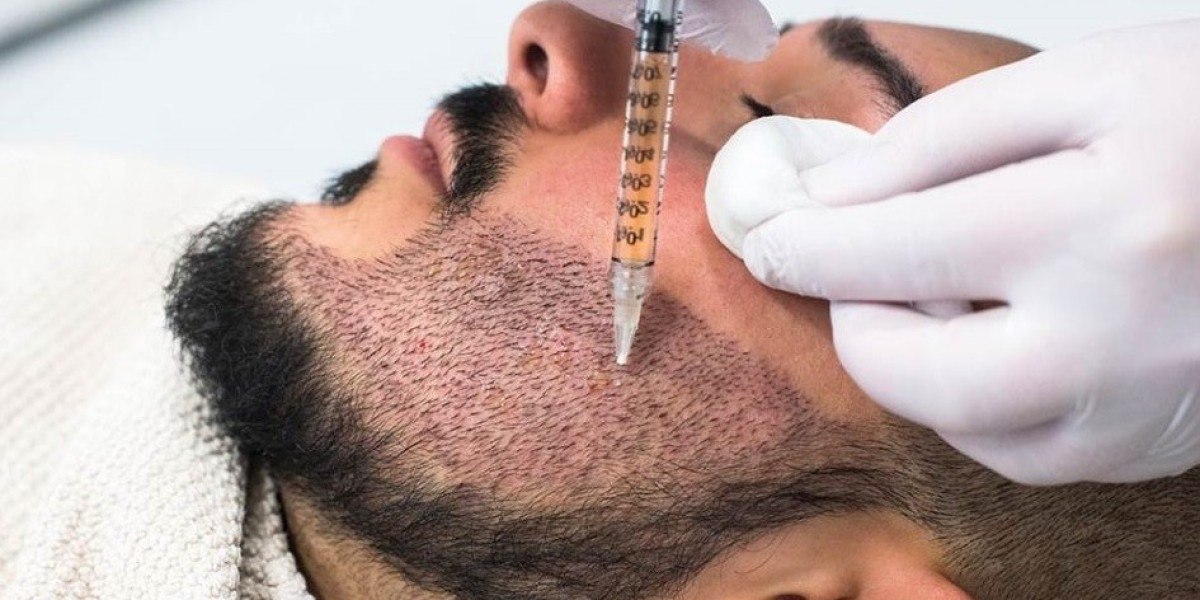 Recovery Guide for Beard Hair Transplants in Riyadh