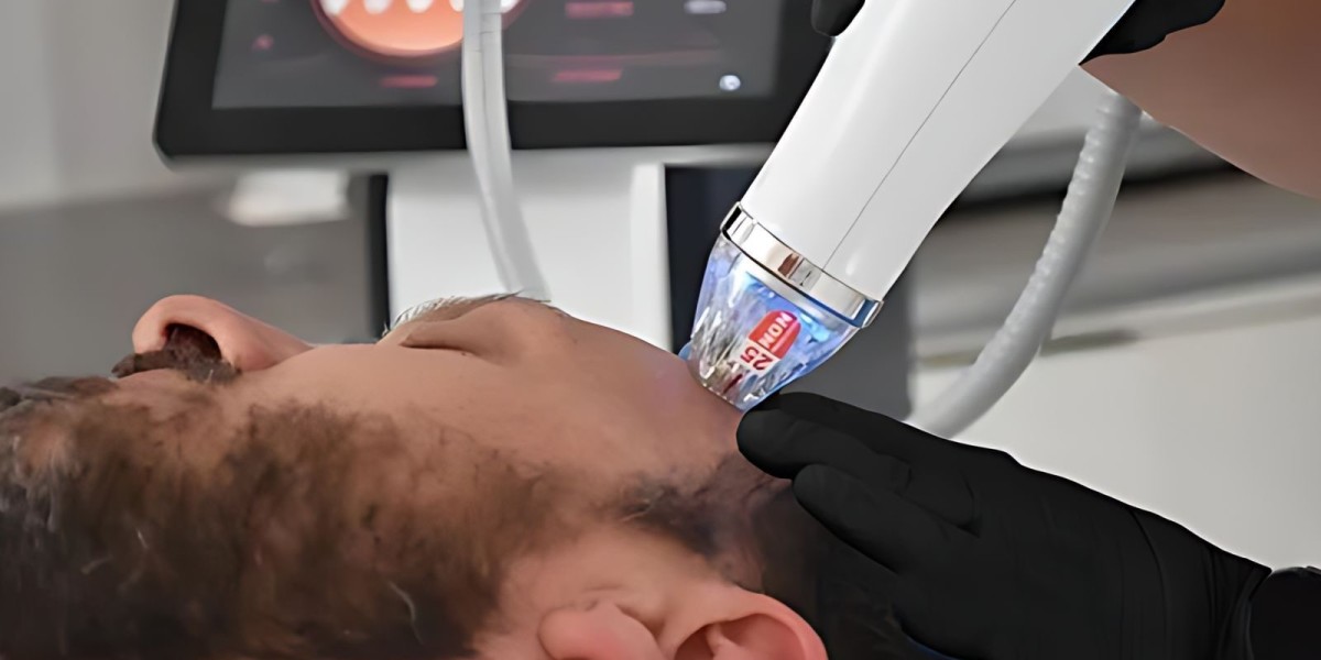 How Fractional RF Microneedling Can Help with Rosacea in Dubai