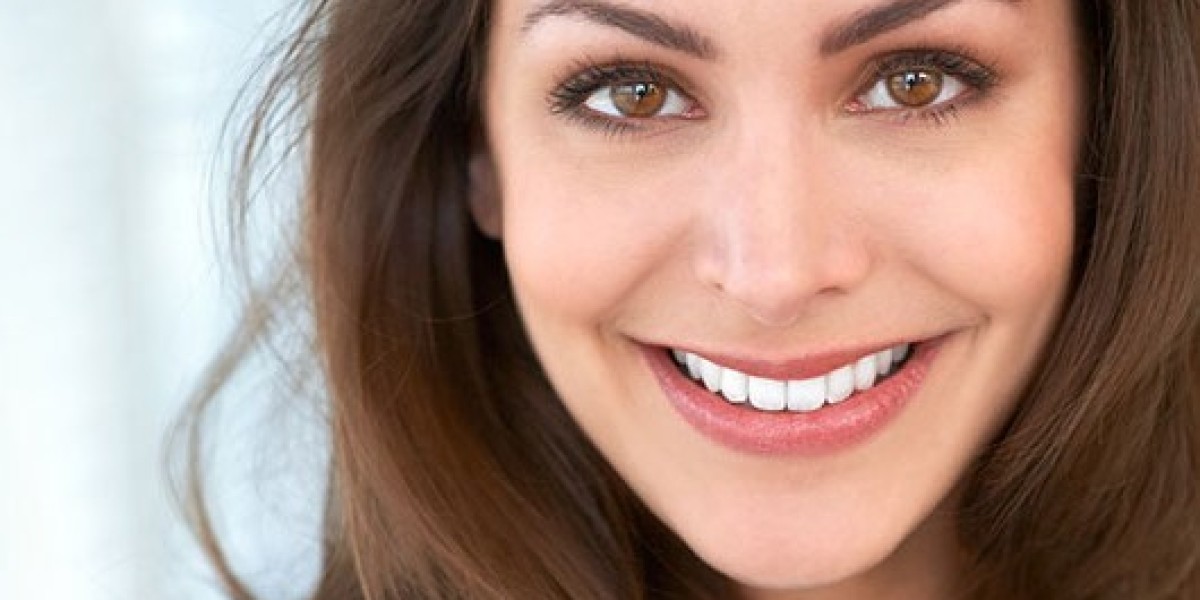 Teeth Whitening in Dubai: Your Guide to Brightening Smiles