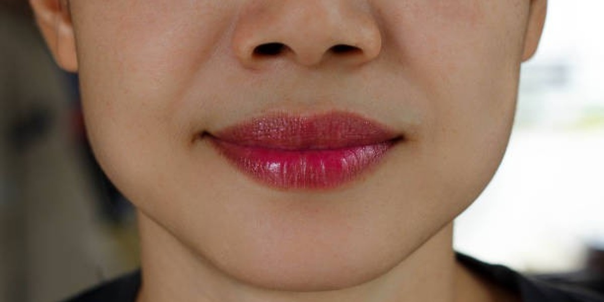 Choosing the Right Specialist for Lip Thinning in Riyadh