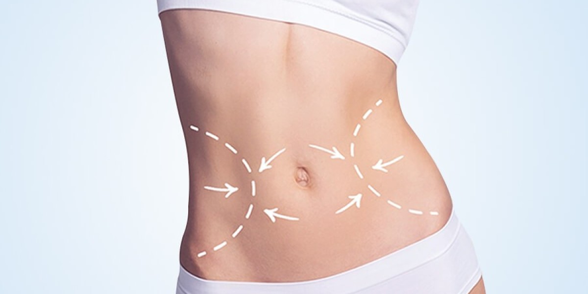 How to Prepare for Your Tummy Tuck Surgery in Riyadh