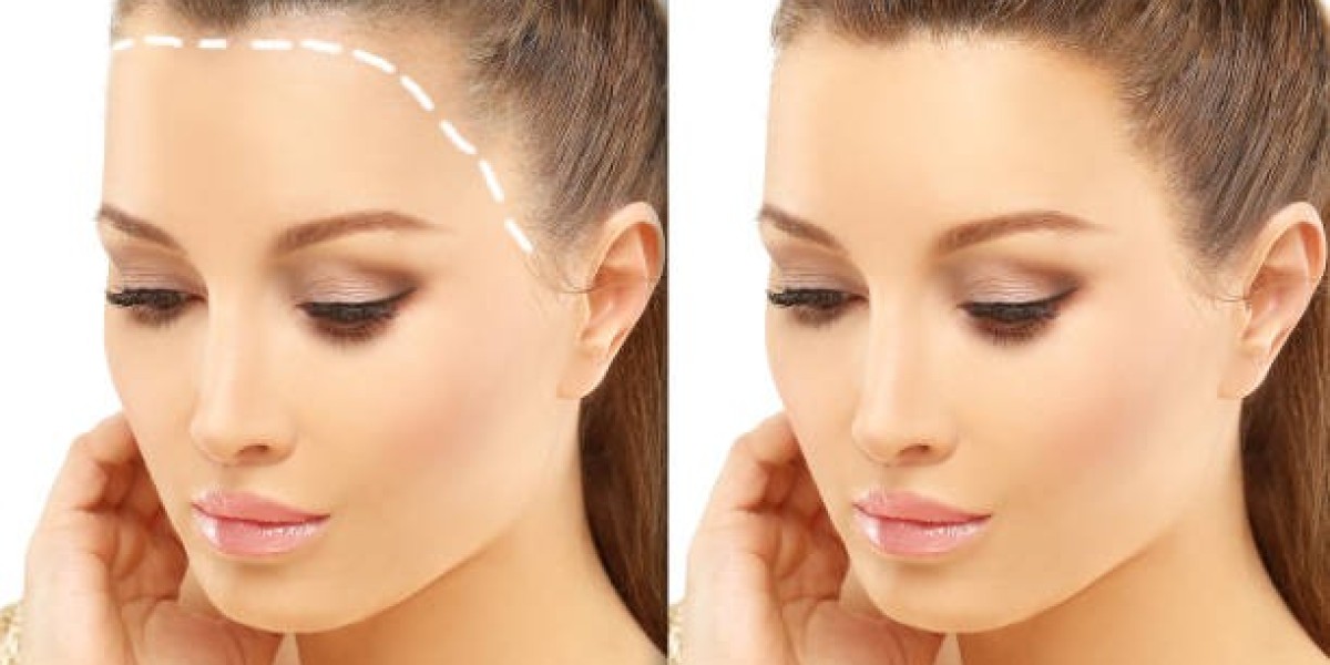 The Future of Hair Restoration in Ras Al Khaimah