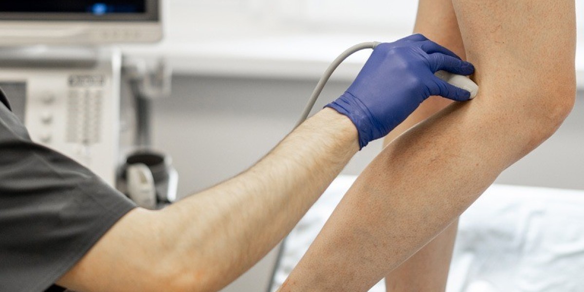 Reasons Why Vein Treatment Frisco Is Worth The Investment