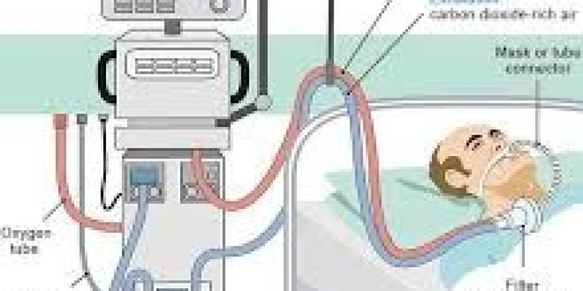 Mechanical Respirator Market Poised for Record Growth by 2034