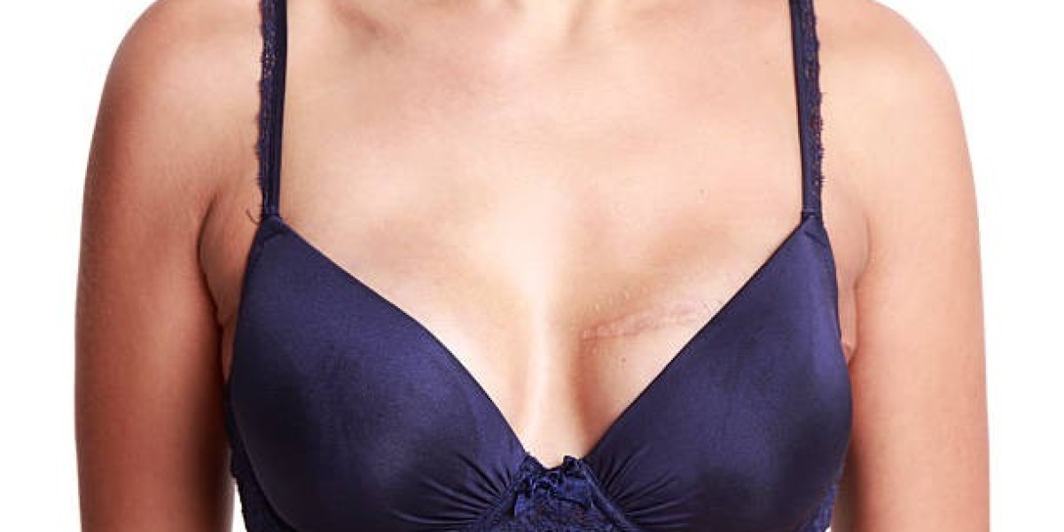 Transform Your Look with Breast Implants in Riyadh