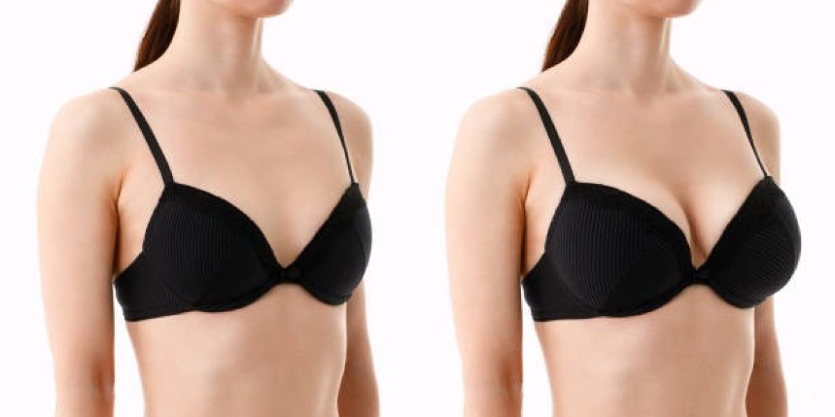 Enhance Your Look with Breast Implants in Riyadh