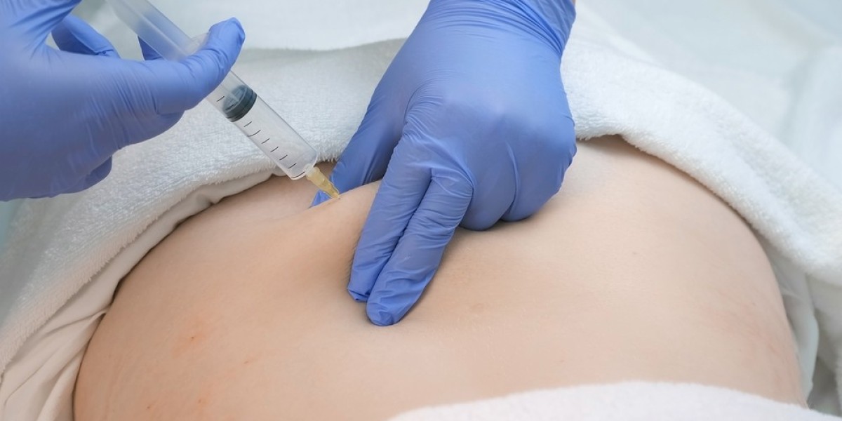 Ozone Injection Therapy: A Breakthrough in Pain and Inflammation Management