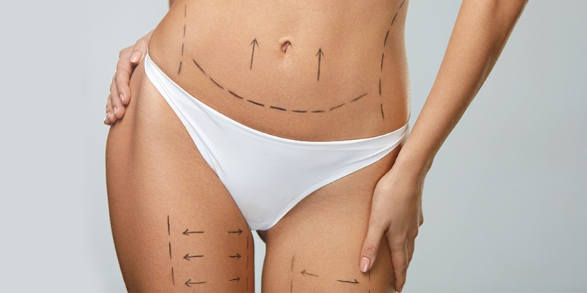 How to Choose a Surgeon for the Best Liposuction Surgery in Riyadh