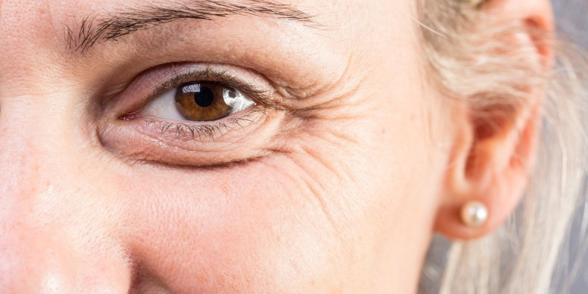 How Diet and Hydration Affect Fine Lines