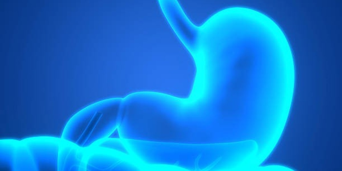 Everything You Need to Know About Gastric Sleeve in Riyadh’s Top Hospitals