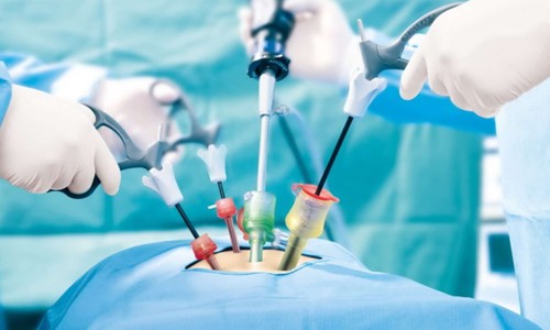 Laproscopic Surgery