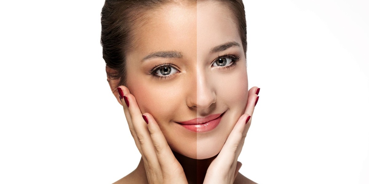 Skin Whitening for Men: Clinics in Riyadh