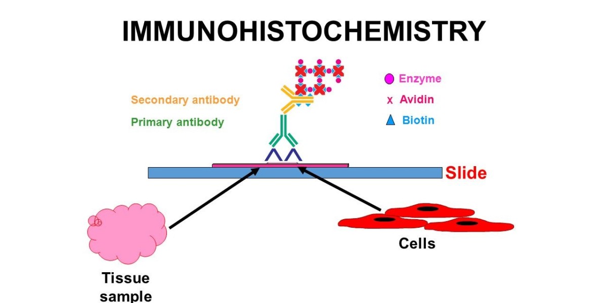 Immunohistochemistry Market Demand, Key Growth, Opportunities, Development and Forecasts to 2024-2034
