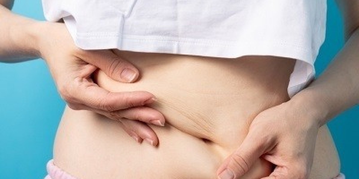 Slim Down Safely with Islamabad Liposuction Experts