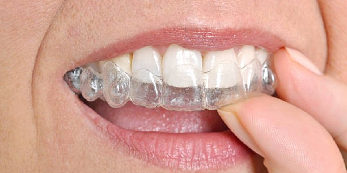 Orthodontics in Riyadh: Your Path to a Perfect Smile