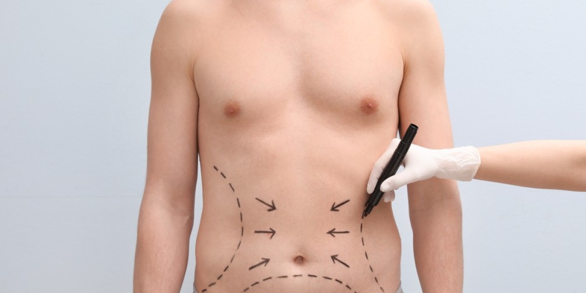 Riyadh’s Leading Clinics for Tummy Tuck Procedures