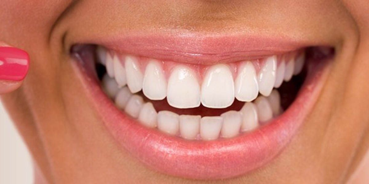 What to Expect from Teeth Whitening Procedures in Dubai