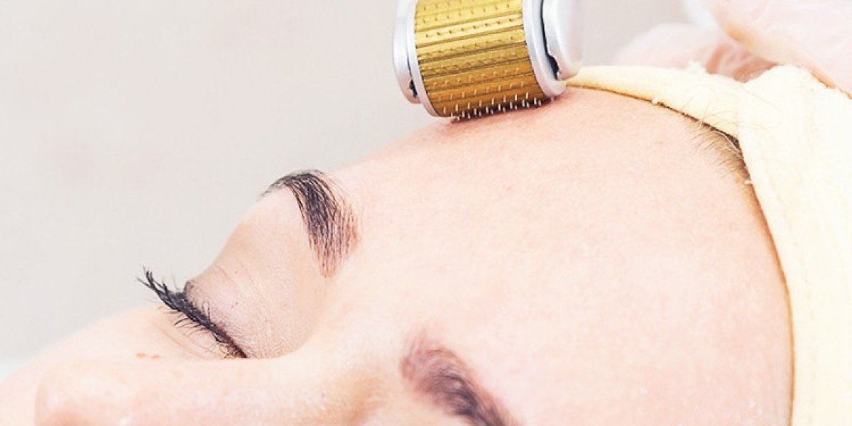 Best Deals on Derma Roller Treatment Packages in Riyadh
