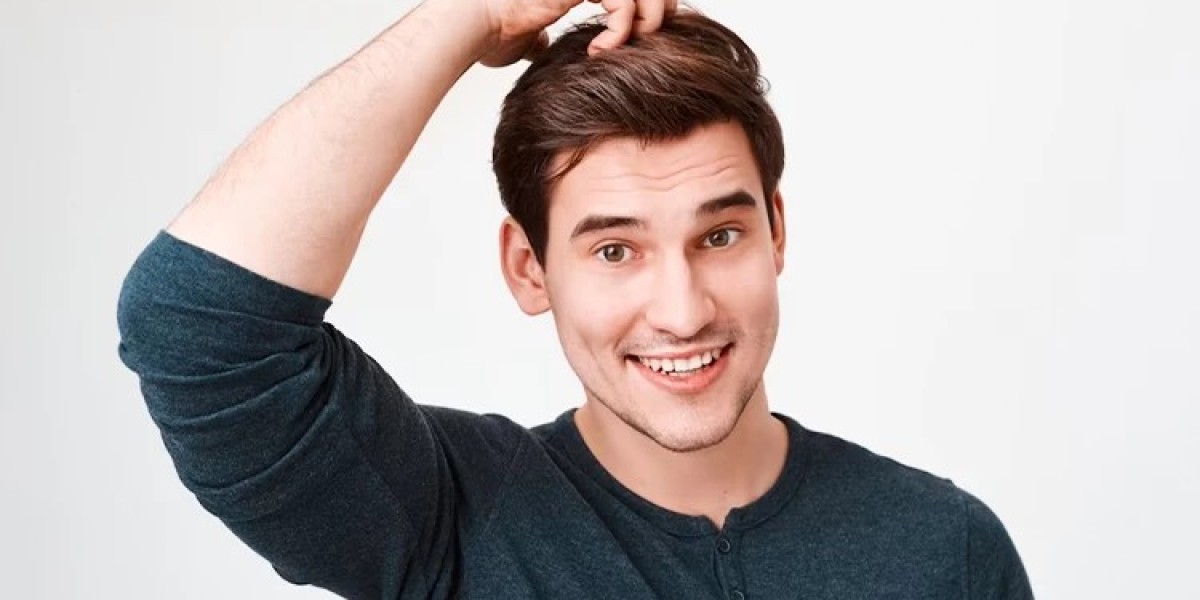 Is a hair transplant a permanent solution?