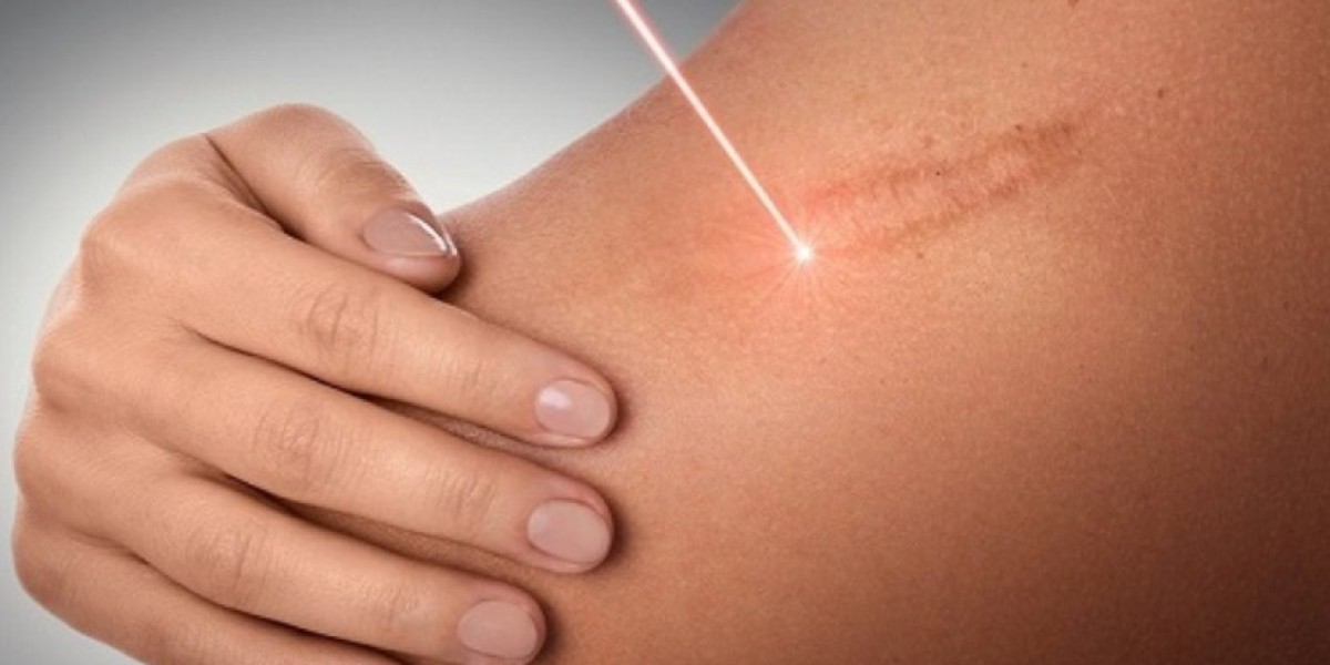 Global Scar Treatment Market Share, Size, Trends, Outlook, Growth & Forecast | 2024 - 2032