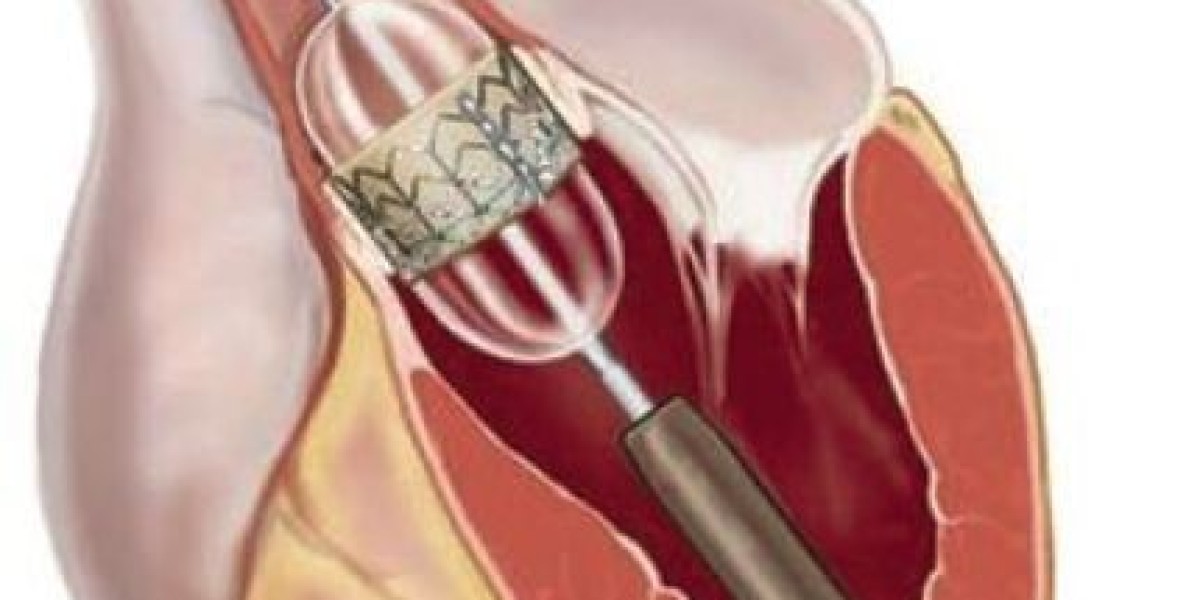 Prosthetic Heart Valves Market Growth Analysis: Key Drivers, Trends, and Strategic Priorities