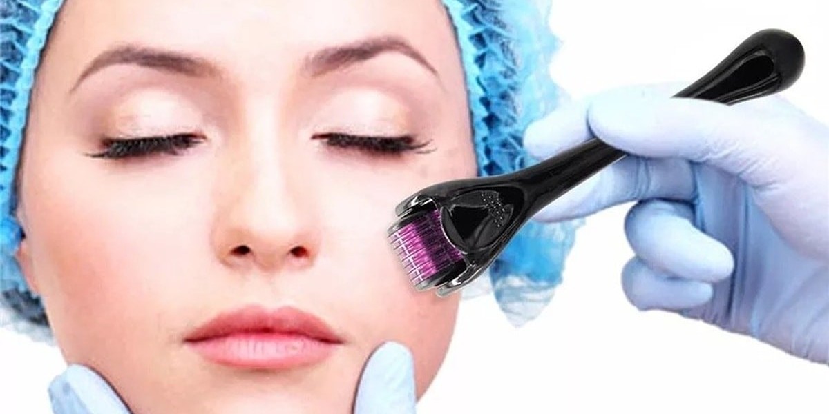The Cost of Derma Roller Treatments in Riyadh: What to Expect
